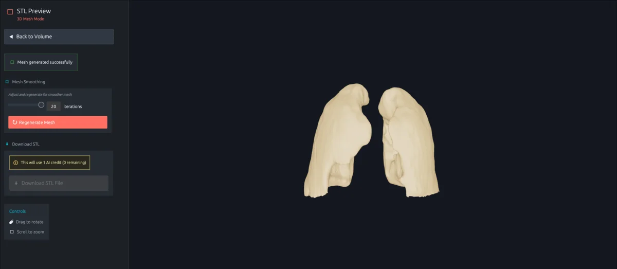 STL lung mesh preview ready for 3D printing