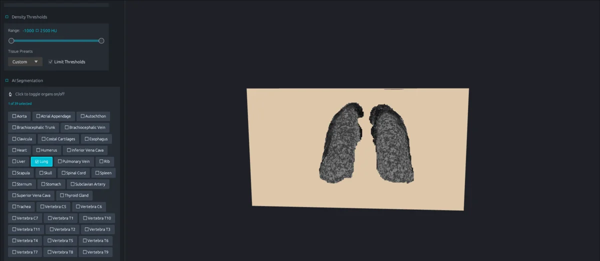 3D CT volume with AI lung segmentation in the DICOM STL viewer