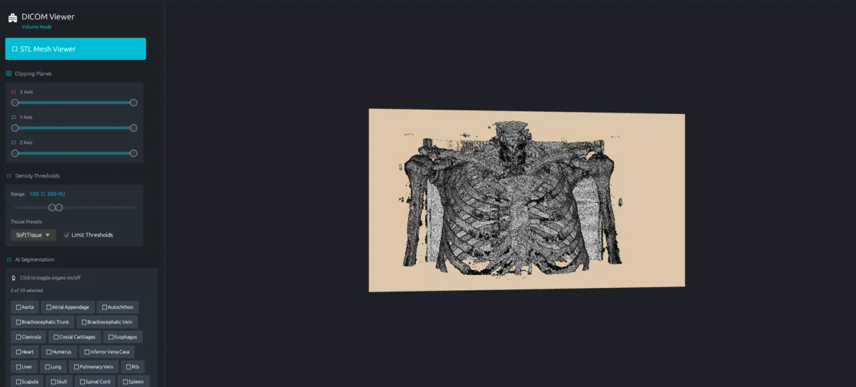 3D CT volume preview with threshold rendering in the DICOM STL viewer